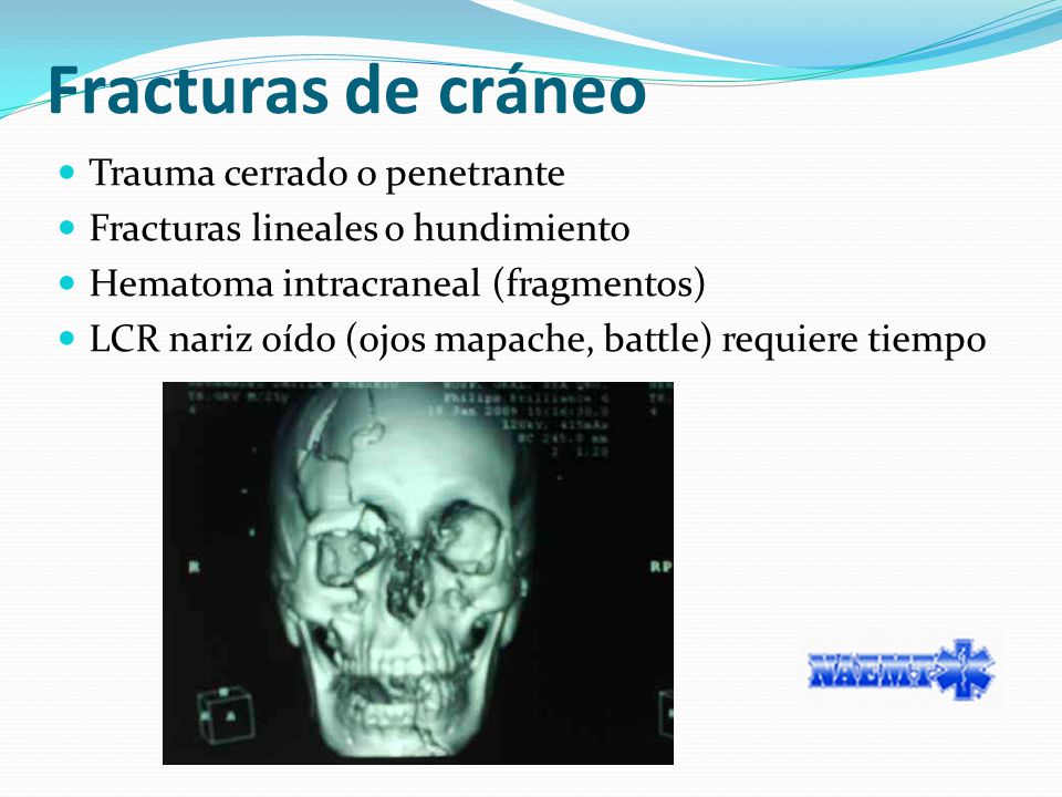 Síntomas penetrantes de fractura de cráneo